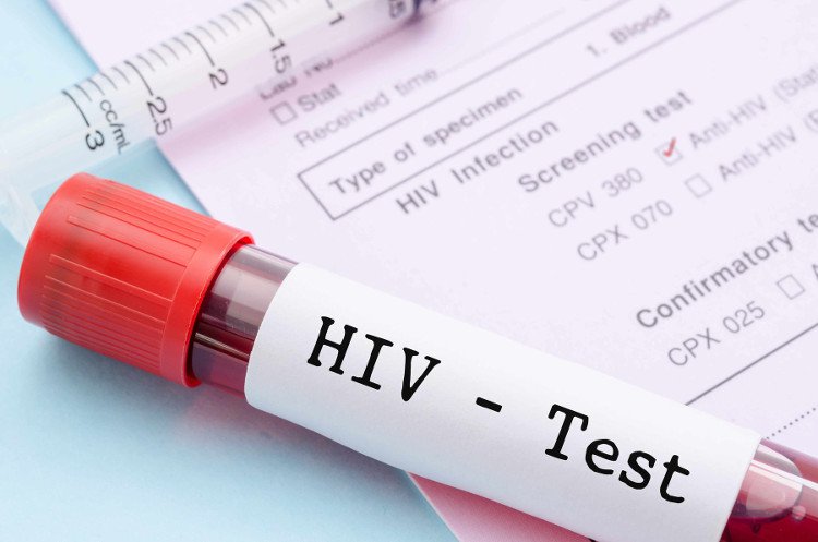 Ứng dụng phương pháp xác định nhiễm mới HIV tại 6 tỉnh, TP