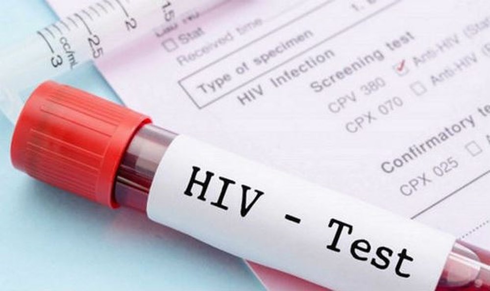 Những trường hợp bắt buộc xét nghiệm HIV