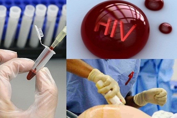 Quy định mới về quản lý điều trị người phơi nhiễm HIV