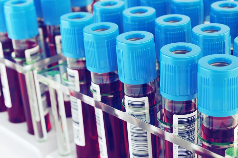 Giá xét nghiệm máu - Xét nghiệm nước tiểu là bao nhiêu?