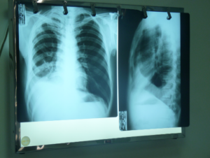 Định mức sử dụng máy X - quang phục vụ trong hoạt động y tế