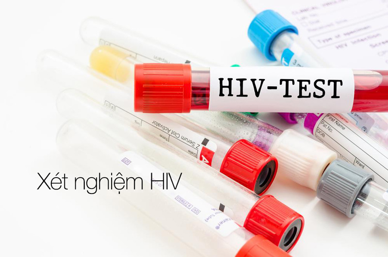 Thời gian thông báo kết quả xét nghiệm HIV dương tính là bao lâu?