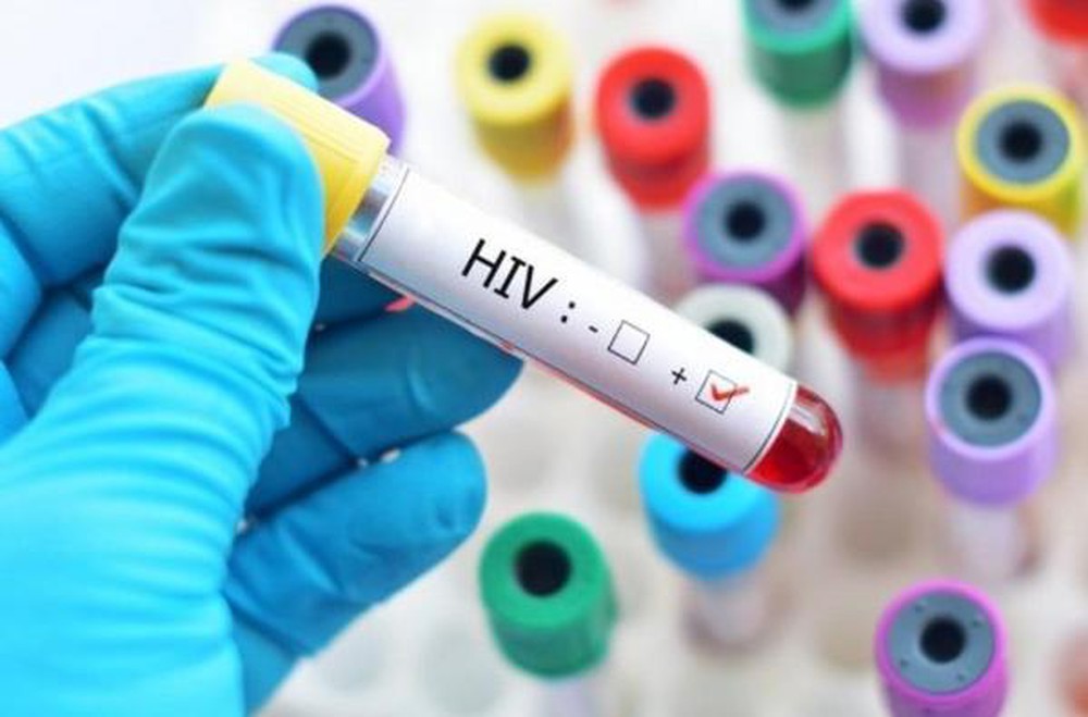 04 đối tượng có trách nhiệm thông báo kết quả xét nghiệm HIV dương tính