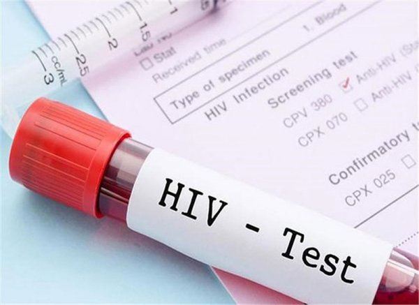 Sở Y tế tỉnh có trách nhiệm gì trong báo cáo công tác phòng, chống HIV/AIDS?