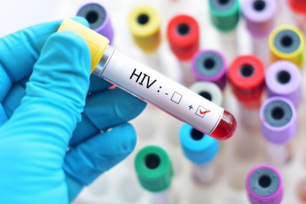 Trung tâm phòng, chống HIV/AIDS tỉnh phải giúp SYT kiểm tra, giám sát