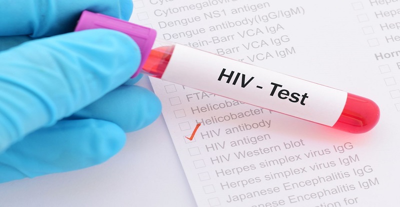 Xét nghiệm HIV người dưới 16t không được sự đồng ý của cha, mẹ, mức phạt ra sao?