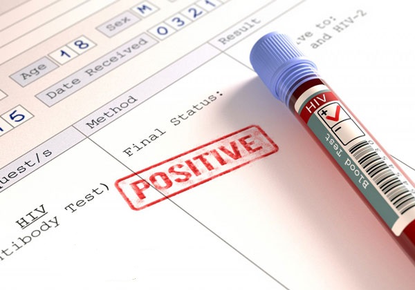 Ai là người được thông báo về kết quả xét nghiệm HIV dương tính?