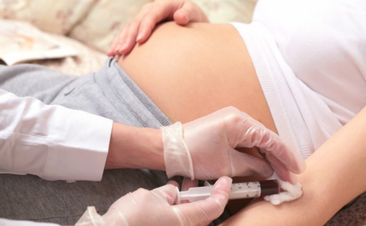Thời điểm, số lần xét nghiệm HIV cho phụ nữ mang thai