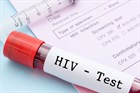 Điều kiện thực hiện xét nghiệm sàng lọc HIV