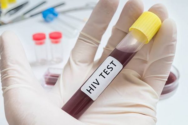 What are procedures for notifying HIV-positive test results to individuals tested for HIV at medical facilities in Vietnam?