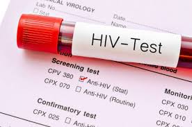 Thời gian trả lời kết quả khi xét nghiệm HIV cho trẻ dưới 18 tháng tuổi