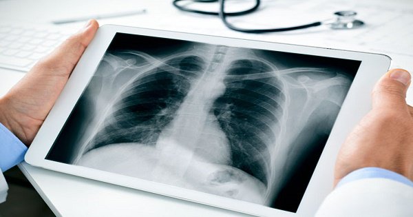 Người đứng đầu phòng chụp X - quang có phải có chứng chỉ gì không?