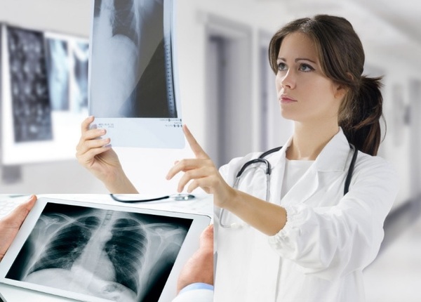 Kỹ thuật viên chụp x-quang mang bầu có được phân làm công việc khác không?