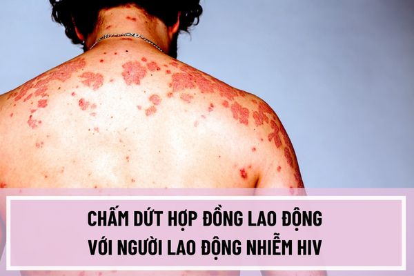 Người sử dụng lao động có được chấm dứt hợp đồng lao động với người lao động nhiễm HIV không?